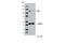 Janus Kinase 2 antibody, 3230S, Cell Signaling Technology, Western Blot image 