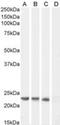 Suppressor Of Cytokine Signaling 1 antibody, NB100-781, Novus Biologicals, Western Blot image 