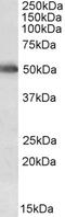 Cytochrome P450 Family 2 Subfamily E Member 1 antibody, abx432572, Abbexa, Western Blot image 