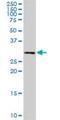 Phosphatidylcholine Transfer Protein antibody, H00058488-D01P, Novus Biologicals, Western Blot image 