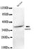 Alpha-Methylacyl-CoA Racemase antibody, LS-C393539, Lifespan Biosciences, Western Blot image 