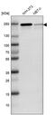 Lysine Demethylase 3B antibody, PA5-53459, Invitrogen Antibodies, Western Blot image 