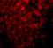 Lysine Demethylase 3B antibody, NBP1-77071, Novus Biologicals, Immunocytochemistry image 