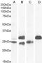 Troponin I3, Cardiac Type antibody, LS-C186615, Lifespan Biosciences, Western Blot image 