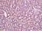 Matrix Metallopeptidase 13 antibody, orb185143, Biorbyt, Immunohistochemistry paraffin image 