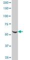 Lysine Acetyltransferase 2A antibody, H00002648-M06, Novus Biologicals, Western Blot image 