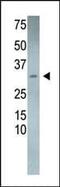 RCAN Family Member 3 antibody, PA5-13336, Invitrogen Antibodies, Western Blot image 