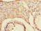 Cysteine And Serine Rich Nuclear Protein 2 antibody, LS-C675603, Lifespan Biosciences, Immunohistochemistry paraffin image 