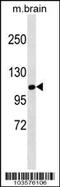 Salt Inducible Kinase 1 antibody, 63-396, ProSci, Western Blot image 