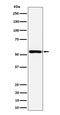 EGF Domain Specific O-Linked N-Acetylglucosamine Transferase antibody, M09267, Boster Biological Technology, Western Blot image 