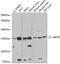 Huntingtin Interacting Protein 1 Related antibody, GTX65566, GeneTex, Western Blot image 