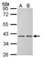 Small Glutamine Rich Tetratricopeptide Repeat Containing Alpha antibody, GTX101532, GeneTex, Western Blot image 