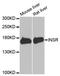 Insulin Receptor antibody, A0005, ABclonal Technology, Western Blot image 