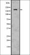 Transient Receptor Potential Cation Channel Subfamily M Member 2 antibody, orb336620, Biorbyt, Western Blot image 
