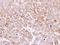 Mannosyl (Beta-1,4-)-Glycoprotein Beta-1,4-N-Acetylglucosaminyltransferase antibody, LS-C186248, Lifespan Biosciences, Immunohistochemistry frozen image 