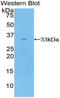 SH2 Domain Containing Adaptor Protein B antibody, LS-C296503, Lifespan Biosciences, Western Blot image 