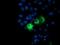 Protein Phosphatase, Mg2+/Mn2+ Dependent 1B antibody, NBP2-45383, Novus Biologicals, Immunofluorescence image 