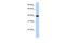 ETS Transcription Factor ELK1 antibody, 27-316, ProSci, Enzyme Linked Immunosorbent Assay image 