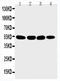 Matrilin 3 antibody, LS-C313063, Lifespan Biosciences, Western Blot image 
