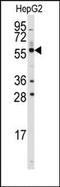 Aldehyde Dehydrogenase 4 Family Member A1 antibody, AP14723PU-N, Origene, Western Blot image 