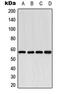 Cytochrome P450 Family 2 Subfamily E Member 1 antibody, GTX56290, GeneTex, Western Blot image 