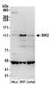 Salt Inducible Kinase 2 antibody, A302-676A, Bethyl Labs, Western Blot image 
