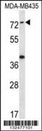 Synaptotagmin Like 1 antibody, 56-664, ProSci, Western Blot image 