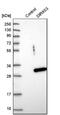 DIRAS Family GTPase 3 antibody, NBP1-90106, Novus Biologicals, Western Blot image 