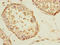 Steroidogenic Acute Regulatory Protein antibody, A61174-100, Epigentek, Immunohistochemistry paraffin image 