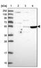 TSPY Like 4 antibody, PA5-60849, Invitrogen Antibodies, Western Blot image 