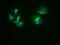 Keratin 18 antibody, GTX84256, GeneTex, Immunofluorescence image 