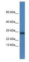 NADH:Ubiquinone Oxidoreductase Core Subunit V2 antibody, NBP1-79680, Novus Biologicals, Western Blot image 