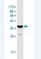 Programmed Cell Death 10 antibody, H00011235-M05-100ug, Novus Biologicals, Western Blot image 