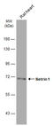 Netrin 1 antibody, GTX133213, GeneTex, Western Blot image 