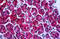 Phosphoglycerate Dehydrogenase antibody, MBS245691, MyBioSource, Immunohistochemistry paraffin image 