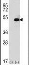 Sphingosine Kinase 1 antibody, PA5-26261, Invitrogen Antibodies, Western Blot image 