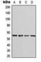 NFS1 Cysteine Desulfurase antibody, orb341143, Biorbyt, Western Blot image 