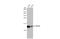 Replication Protein A3 antibody, GTX100088, GeneTex, Western Blot image 