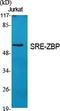 Zinc Finger And SCAN Domain Containing 26 antibody, A14317, Boster Biological Technology, Western Blot image 