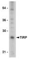 Transmembrane emp24 domain-containing protein 7 antibody, AP05229PU-N, Origene, Western Blot image 