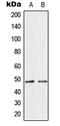 Transcription factor GATA-4 antibody, MBS8211335, MyBioSource, Western Blot image 