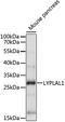 Lysophospholipase Like 1 antibody, LS-C750183, Lifespan Biosciences, Western Blot image 