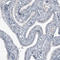 SRY-Box 21 antibody, AMAb91311, Atlas Antibodies, Immunohistochemistry paraffin image 