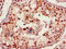 Forkhead Box M1 antibody, LS-C671847, Lifespan Biosciences, Immunohistochemistry paraffin image 