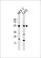 SLC9A3 Regulator 1 antibody, MBS9210370, MyBioSource, Western Blot image 