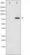 Tumor Protein P73 antibody, TA325959, Origene, Western Blot image 