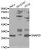 Synaptosome Associated Protein 25 antibody, LS-C331188, Lifespan Biosciences, Western Blot image 