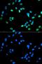 Interferon Regulatory Factor 5 antibody, GTX54336, GeneTex, Immunocytochemistry image 