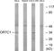 Olfactory Receptor Family 7 Subfamily C Member 1 antibody, PA5-39670, Invitrogen Antibodies, Western Blot image 