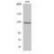 Protein Tyrosine Kinase 2 antibody, LS-C383459, Lifespan Biosciences, Western Blot image 